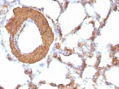 Immunohistochemistry-Paraffin: Actin (Muscle Specific) Antibody (HHF35 + MSA/953) - Azide and BSA Free [NBP2-47663] - Rat Lung stained with Muscle Specific Actin Monoclonal Antibody (HHF35 + MSA/953)