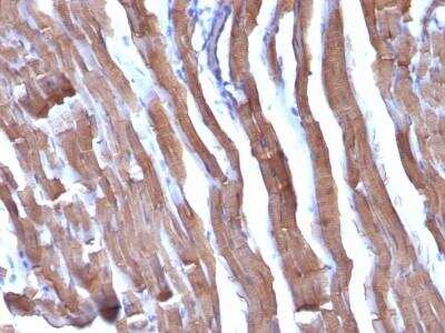 Immunohistochemistry-Paraffin: Actin (Muscle Specific) Antibody (HHF35 + MSA/953) - Azide and BSA Free [NBP2-47663] - Rat Heart stained with Muscle Specific Actin Monoclonal Antibody (HHF35 + MSA/953)