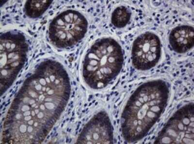 Immunohistochemistry: pan Cadherin Antibody (4F1) [NBP2-46200] - Analysis of Human colon tissue. (Heat-induced epitope retrieval by 10mM citric buffer, pH6.0, 120C for 3min)