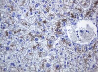 Immunohistochemistry: pan Cadherin Antibody (4F1) [NBP2-46200] - Analysis of Human liver tissue. (Heat-induced epitope retrieval by 10mM citric buffer, pH6.0, 120C for 3min)