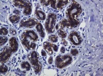 Immunohistochemistry: pan Cadherin Antibody (4F1) [NBP2-46200] - Analysis of Human breast tissue. (Heat-induced epitope retrieval by 10mM citric buffer, pH6.0, 120C for 3min)