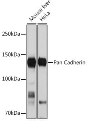 Western Blot: pan Cadherin Antibody (6N5P8) [NBP3-16509] - Western blot analysis of extracts of various cell lines, using pan Cadherin Rabbit mAb (NBP3-16509) at 1:1000 dilution. Secondary antibody: HRP Goat Anti-Rabbit IgG (H+L) at 1:10000 dilution. Lysates/proteins: 25ug per lane. Blocking buffer: 3% nonfat dry milk in TBST. Detection: ECL Basic Kit. Exposure time: 30s.