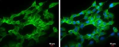 Immunocytochemistry/Immunofluorescence: pan Cadherin Antibody [NBP3-13122] - pan Cadherin antibody detects pan Cadherin protein at cell membrane by immunofluorescent analysis. Sample: SK-N-AS cells were fixed in ice-cold MeOH for 5 min. Green: pan Cadherin protein stained by pan Cadherin antibody (NBP3-13122) diluted at 1:500. Blue: Hoechst 33342 staining. Scale bar = 10 um.