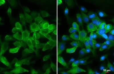 <b>Independent Antibodies Validation. </b>Immunocytochemistry/Immunofluorescence: pan Cadherin Antibody [NBP3-13122] - pan Cadherin antibody detects pan Cadherin protein at cell membrane by immunofluorescent analysis. Sample: HeLa cells were fixed in ice-cold MeOH for 5 min. Green: pan Cadherin stained by pan Cadherin antibody (NBP3-13122) diluted at 1:1000. Blue: Hoechst 33342 staining. Scale bar= 10 um.