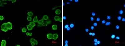 Immunocytochemistry/Immunofluorescence: pan Cadherin Antibody (S04-5A8) [NBP3-15073] - Immunofluorescence of pan Cadherin (green) in MCF-7 using pan Cadherin antibody at dilution 1/5, and DAPI (blue)