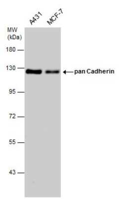 Western Blot: pan Cadherin Antibody [NBP3-13122] - Various whole cell extracts (30 ug) were separated by 7.5% SDS-PAGE, and the membrane was blotted with pan Cadherin antibody (NBP3-13122) diluted at 1:5000.