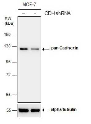 <b>Genetic Strategies Validation. </b>Western Blot: pan Cadherin Antibody [NBP3-13122] - Non-transfected (-) and transfected (+) MCF-7 whole cell extracts (30 ug) were separated by 7.5% SDS-PAGE, and the membrane was blotted with pan Cadherin antibody (NBP3-13122) diluted at 1:4000.