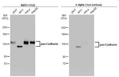Western Blot: pan Cadherin Antibody [NBP3-13122] - Various whole cell extracts (30 ug) were separated by 5% SDS-PAGE, and the membranes were blotted with pan Cadherin antibody (NBP3-13122) diluted at 1:1000 and competitor's antibody diluted at 1:1000. The HRP-conjugated anti-rabbit IgG antibody (NBP2-19301) was used to detect the primary antibody.
