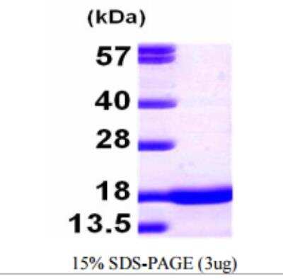 SDS-Page: pan-Synuclein Protein [NBP1-72278]