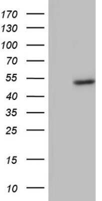 Western Blot: phakinin Antibody (OTI4E7) - Azide and BSA Free [NBP2-73365] - Analysis of HEK293T cells were transfected with the pCMV6-ENTRY control (Left lane) or pCMV6-ENTRY Phakinin.