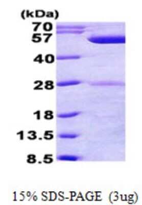 SDS-Page: Recombinant E. coli phrB Protein [NBP2-22657]