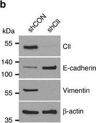 Loss of miR-101 promotes cancer metastasis through de-repression of COUP-TFII expression.(a) LNCaP and PC3 cells were individually treated with 50 nM of miR-101 and miR-27a mimic for 48 h and then invasion assays were performed for an additional 16 h (n=3). *P<0.05 (two-sided Student's t-test) compared with the control group. (b) Representative western blot showed the levels of COUP-TFII, E-cadherin, vimentin and  beta -actin in PC3 cells stably knocked down by COUP-TFII. (c) LNCaP and PC3 cells stably knocked-down of COUP-TFII were used to perform cell invasion assay. Invaded cells were stained and counted (lower panel) (n=3). Representative western blot showed the knockdown efficiency of COUP-TFII (upper panel). *: P<0.05 (two-sided Student's t-test) compared with control group. (d) PC3 cells carrying an inducible miR-101 in the absence and presence of doxycycline, and re-expression of COUP-TFII were used to perform invasion assays (n=3). Representative western blot showed the levels of COUP-TFII and  beta -actin (left). Invaded cells were counted and results are shown in the right panel. *: P<0.05 (two-sided Student's t-test) (e) 22RV-1 cells were treated with miR-101 inhibitor (antisense RNA) in conjunction with knockdown of COUP-TFII and used for invasion assays (n=3). Representative western blot show the levels of COUP-TFII and  beta -actin (left). Invaded cells were counted and result is shown in the right panel. *: P<0.05 (two-sided Student's t-test). (f) LNCaP cells containing a construct with inducible expression of COUP-TFII shRNA and constructs expressing with anti-miR-101 and anti-mir-27a were orthotopically injected into NOD-SCID mouse prostate. In addition these cells also contain a luciferase reporter to detect cancer cells. After the tumour size was bigger than 50 mm3, drinking water with or without doxycycline (1 mg ml−1) was given to the mice for 6 weeks to induce the COUP-TFII shRNA to repress COUP-TFII expression. Representative bioluminescence results show th
