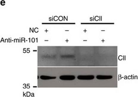 Loss of miR-101 promotes cancer metastasis through de-repression of COUP-TFII expression.(e) 22RV-1 cells treated with miR-101 inhibitor (antisense RNA) in conjunction with knockdown of COUP-TFII&used for invasion assays (n=3). Representative WB show the levels of COUP-TFII& beta -actin (left). Invaded cells counted&result is shown in the right panel. *: P<0.05 (two-sided Student's t-test). Image collected & cropped by CiteAb from the following open publication (//pubmed.ncbi.nlm.nih.gov/27108958), licensed under a CC-BY license. Not internally tested by R&D Systems.