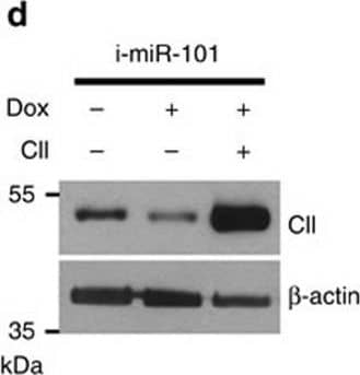 Loss of miR-101 promotes cancer metastasis through de-repression of COUP-TFII expression. (d) PC3 cells carrying an inducible miR-101 in the absence&presence of doxycycline,&re-expression of COUP-TFII used to perform invasion assays (n=3). Representative WB showed the levels of COUP-TFII& beta -actin (left). Invaded cells counted&results are shown in the right panel. *: P<0.05 (two-sided Student's t-test). Image collected & cropped by CiteAb from the following open publication (//pubmed.ncbi.nlm.nih.gov/27108958), licensed under a CC-BY license. Not internally tested by R&D Systems.