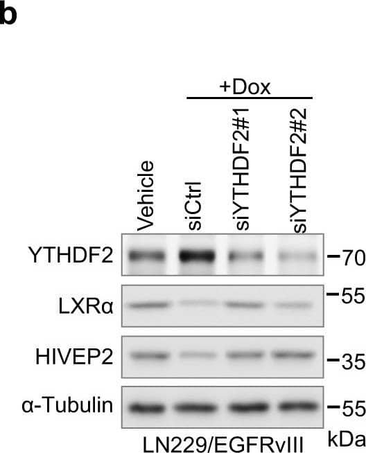 YTHDF2 downregulates LXRA and HIVEP2 through m6A-dependent mRNA decay. b Western blotting of LXR alpha  and HIVEP2 in LN229/EGFRvIII tet-on cells cultured with vehicle or Doxycycline and transfected with control siRNA or two individual YTHDF2 siRNAs Image collected and cropped by CiteAb from the following open publication (//pubmed.ncbi.nlm.nih.gov/33420027), licensed under a CC-BY license. Not internally tested by R&D Systems.