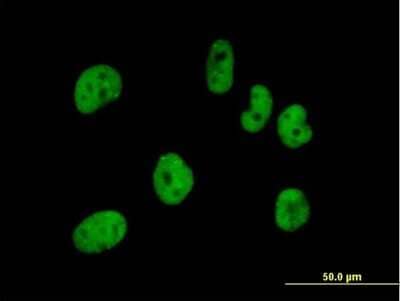 Immunocytochemistry/Immunofluorescence: pre-mRNA cleavage factor I (59 kDa subunit) Antibody [H00079869-B01P] - Analysis of purified antibody to FLJ12529 on HeLa cell. (antibody concentration 10 ug/ml)