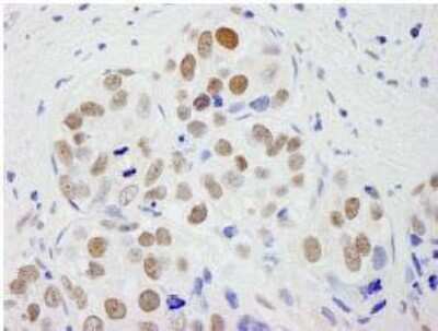 Immunohistochemistry-Paraffin pre-mRNA cleavage factor I (59 kDa subunit) Antibody