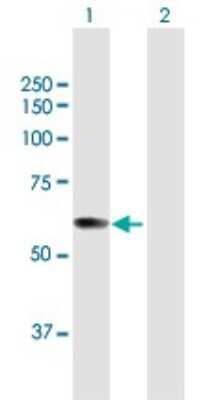 Western Blot pre-mRNA cleavage factor I (59 kDa subunit) Antibody