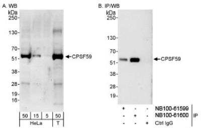Western Blot: pre-mRNA cleavage factor I (59 kDa subunit) Antibody [NB100-61599] - Detection of Human CPSF59 on HeLa whole cell lysate using NB100-61599. CPSF59  was also immunoprecipitated by rabbit anti-CPSF59 antibody NB100-61600.
