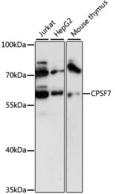Western Blot: pre-mRNA cleavage factor I (59 kDa subunit) Antibody [NBP2-94718] - Analysis of extracts of various cell lines, using pre-mRNA cleavage factor I (59 kDa subunit) at 1:3000 dilution.Secondary antibody: HRP Goat Anti-Rabbit IgG (H+L) at 1:10000 dilution.Lysates/proteins: 25ug per lane.Blocking buffer: 3% nonfat dry milk in TBST.Detection: ECL Basic Kit .Exposure time: 10s.