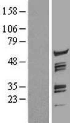 Western Blot pre-mRNA cleavage factor I (59 kDa subunit) Overexpression Lysate