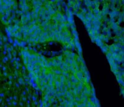 Immunocytochemistry/Immunofluorescence: proBDNF Antibody [NB100-98754] - IF on rat hypophysis at 40 ug/ml concentration using Sheep antibody to rat, mouse, zebra fish proBDNF (pro BDNF, pro Brain-derived neurotrophic factor): IgG, DAPI counterstained.