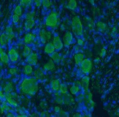 Immunocytochemistry/Immunofluorescence: proBDNF Antibody [NB100-98756] - Rat DRG at 40 ug/ml concentration using Rabbit antibody to rat, mouse, zebra fish proBDNF (pro BDNF, pro Brain-derived neurotrophic factor): IgG, DAPI counterstained appearing in blue.