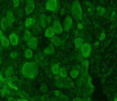 Immunocytochemistry/Immunofluorescence: proBDNF Antibody [NB100-98756] - Rat DRG at 40 ug/ml concentration using Rabbit antibody to rat, mouse, zebra fish proBDNF (pro BDNF, pro Brain-derived neurotrophic factor): IgG, DAPI counterstained.