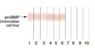 Western Blot: proBNP Antibody (11D1) [NB120-13059] - Detection of human recombinant proBNP expressed in mammalian cells in Western blotting by different monoclonal antibodies after Tricine-SDS gel electrophoresis. Lanes: 1 - MAb 5B61-12; 2 - 29D125-12; 3 - 15F1113-24; 4 - 13G1213-20; 5 - 18H513-20; 6 - 16F313-20; 7 - 11D131-39; 8 - 15D748-56; 9 - 15C463-71; 10 - 24E1167-76. Antigen: recombinant proBNP expressed in mammalian cells 0.15 ug/line. MAbs 11D131-39, 15D748-56, 15C463-71 and 24E1167-76 does not recognize glycosylated proBNP expressed in the mammalian cell line.