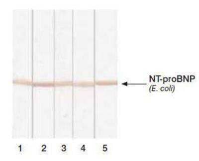 Western Blot: proBNP Antibody (11D1) [NB120-13059] - Detection of human recombinant NT-proBNP expressed in E. coli in Western blotting by different monoclonal antibodies after Tricine- SDS gel electrophoresis. Lanes: 1 - MAb 5B61-12; 2 - 15F1113-24; 3 - 11D131-39; 4 - 15D748-56; 5 - 24E1167-76. Antigen: recombinant NT-proBNP expressed in E. coli, 2.5 ug/well.