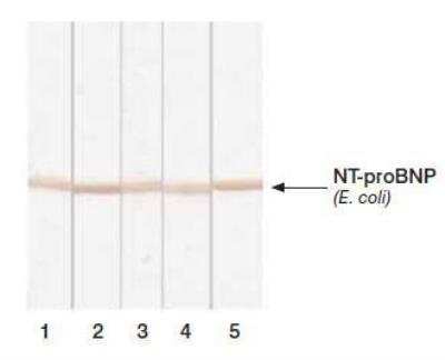 Western Blot: proBNP Antibody (5B6) [NB120-13111] - Detection of human recombinant NT-proBNP expressed in  E. coli in Western blotting by different monoclonal antibodies after Tricine-  SDS gel electrophoresis.  Lanes:  1 - MAb 5B61-12; 2 - 15F1113-24; 3 - 11D131-39; 4 - 15D748-56; 5 -24E1167-76.  Antigen: recombinant NT-proBNP expressed in E. coli, 2.5 ug/well.