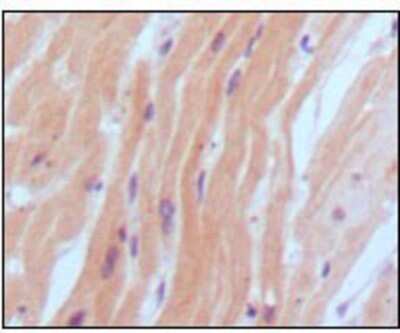 Immunohistochemistry: proBNP Antibody (9H6B4) [NBP1-47508] - Analysis of human normal myocardium, showing cytoplasmic localization using BNP2 mouse mAb with DAB staining.