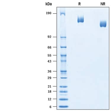 2 μg/lane of Recombinant Mouse Plexin B3 His-tag Protein (Catalog # 10220-PC) was resolved with SDS-PAGE under reducing (R) and non-reducing (NR) conditions and visualized by Coomassie® Blue staining, showing bands at 150-170 kDa.