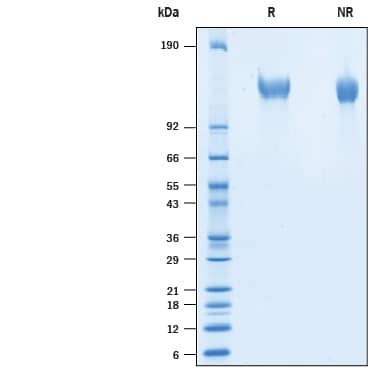 2 μg/lane of Recombinant Cynomolgus CD96 His-tag Protein (10478-CD) was resolved with SDS-PAGE under reducing (R) and non-reducing (NR) conditions and visualized by Coomassie® Blue staining, showing bands at 120-145 kDa.