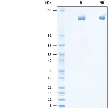 2 μg/lane of Recombinant Mouse Mrc2 His-tag (10491-EN) was resolved with SDS-PAGE under reducing (R) and non-reducing (NR) conditions and visualized by Coomassie® blue staining, showing bands at 145-165 kDa.