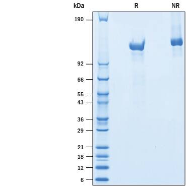 2 μg/lane of Recombinant Mouse CDO His-tag Protein  (10505-CD) was resolved with SDS-PAGE under reducing (R) and non-reducing (NR) conditions and visualized by Coomassie® Blue staining, showing bands at 113-135 kDa.