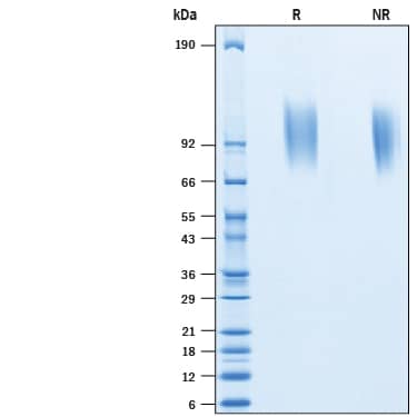 2 μg/lane of Recombinant Human Mer His-tag Protein (Catalog # 10515-MR) was resolved with SDS-PAGE under reducing (R) and non-reducing (NR) conditions and visualized by Coomassie® Blue staining, showing bands at 95-115 kDa.