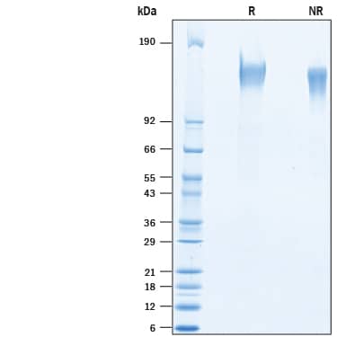 SDS-PAGE SSC5D [Unconjugated]