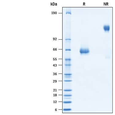 2 μg/lane of Recombinant SARS-CoV Spike RBD Fc Chimera Protein (Catalog # 10559-CV) was resolved with SDS-PAGE under reducing (R) and non-reducing (NR) conditions and visualized by Coomassie® Blue staining, showing bands at 61-67 kDa and 120-130 kDa, respectively.