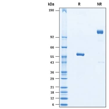 2 μg/lane of Recombinant SARS-CoV-2 Spike RBD His-tag Protein (10565-CV) was resolved with SDS-PAGE under reducing (R) and non-reducing (NR) conditions and visualized by Coomassie® Blue staining, showing bands at 54-60 kDa and 108-120 kDa, respectively.