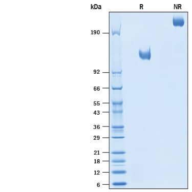 2 μg/lane of Recombinant Rat Siglec-2/CD22 Fc Chimera Protein (Catalog # 10572-SL) was resolved with SDS-PAGE under reducing (R) and non-reducing (NR) conditions and visualized by Coomassie® Blue staining, showing bands at 112-138 kDa and 220-280 kDa, respectively.