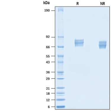2 μg/lane of Recombinant Mouse FLRT3 His-tag Protein (Catalog # 10614-FL) was resolved with SDS-PAGE under reducing (R) and non-reducing (NR) conditions and visualized by Coomassie® Blue staining, showing bands at 67-87 kDa.