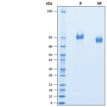 2 μg/lane of Recombinant Rat PDGF R beta His-tag (Catalog # 10616-PR) was resolved with SDS-PAGE under reducing (R) and non-reducing (NR) conditions and visualized by Coomassie® Blue staining, showing bands at 88-102 kDa.