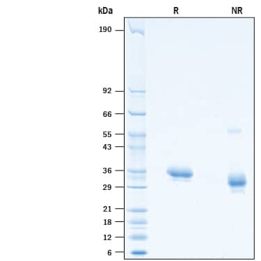 2 μg/lane of Recombinant SARS-CoV-2 V367F Spike RBD His-tag (Catalog # 10626-CV) was resolved with SDS-PAGE under reducing (R) and non-reducing (NR) conditions and visualized by Coomassie® Blue staining, showing bands at 30-38 kDa.