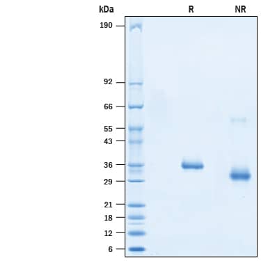 2 μg/lane of Recombinant SARS-CoV-2 G476S Spike RBD His-tag (Catalog # 10627-CV) was resolved with SDS-PAGE under reducing (R) and non-reducing (NR) conditions and visualized by Coomassie® Blue staining, showing bands at 32-40 kDa.