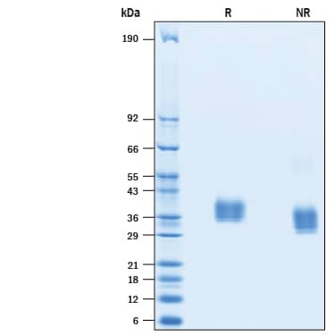 2 μg/lane of Recombinant SARS-CoV-2 V483A Spike RBD His-tag (Catalog # 10628-CV) was resolved with SDS-PAGE under reducing (R) and non-reducing (NR) conditions and visualized by Coomassie® Blue staining, showing bands at 32-40 kDa.