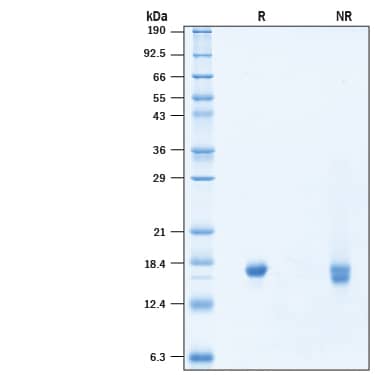 2 μg/lane of Recombinant SARS-CoV-2 NSP10 His-tag (Catalog # 10630-CV) was resolved with SDS-PAGE under reducing (R) and non-reducing (NR) conditions and visualized by Coomassie® Blue staining, showing a band at 16 kDa under reducing conditions.