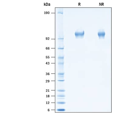 2 μg/lane of Recombinant Ferret ACE-2 His-tag (Catalog # 10635-ZN) was resolved with SDS-PAGE under reducing (R) and non-reducing (NR) conditions and visualized by Coomassie® Blue staining, showing bands at ~101 kDa under reducing conditions.