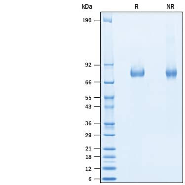 2 μg/lane of Recombinant Mouse ELFN1 His-tag Protein (Catalog # 10644-EF) was resolved with SDS-PAGE under reducing (R) and non-reducing (NR) conditions and visualized by Coomassie® Blue staining, showing bands at 73-84 kDa.