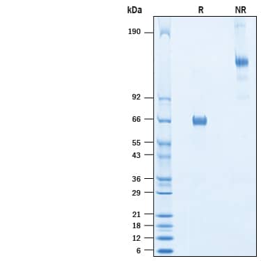 2 μg/lane of Recombinant Human OX40/TNFRSF4 mFc Chimera Protein (Catalog # 10649-OX) was resolved with SDS-PAGE under reducing (R) and non-reducing (NR) conditions and visualized by Coomassie® Blue staining, showing bands at 60-70 kDa and 120-140 kDa, respectively.